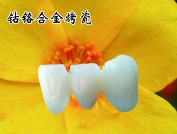钴铬烤瓷牙有毒吗