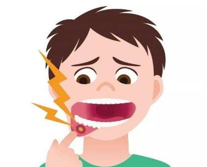 多发性口腔溃疡原因-口腔...
