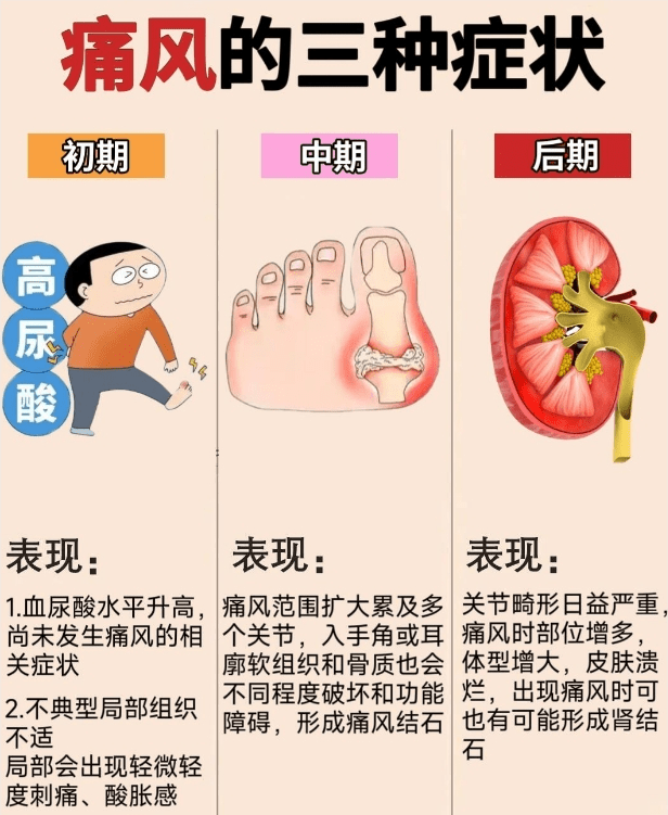 痛风最好吃什么食物